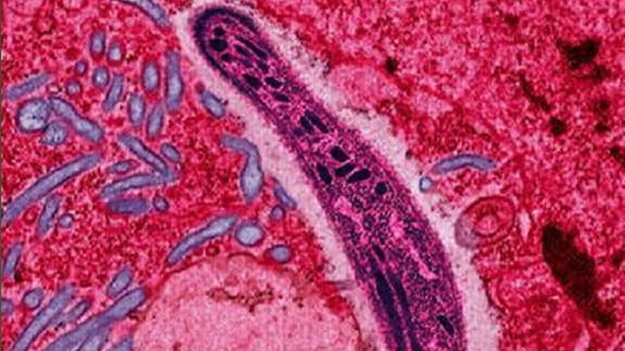 The protozoan Plasmodium falciparum gliding through a cell in the gut of a mosquito