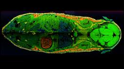 This overlay of mass spectrometry images shows the spatial distribution of three different kind of lipids across a whole mouse cross-section.