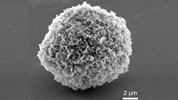 An electron microscope image of a zombie cell.