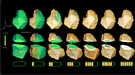 The chemical phase within the battery evolves as the charging time increases. The cut-away views reveal a change from anisotropic to isotropic phase boundary motion.