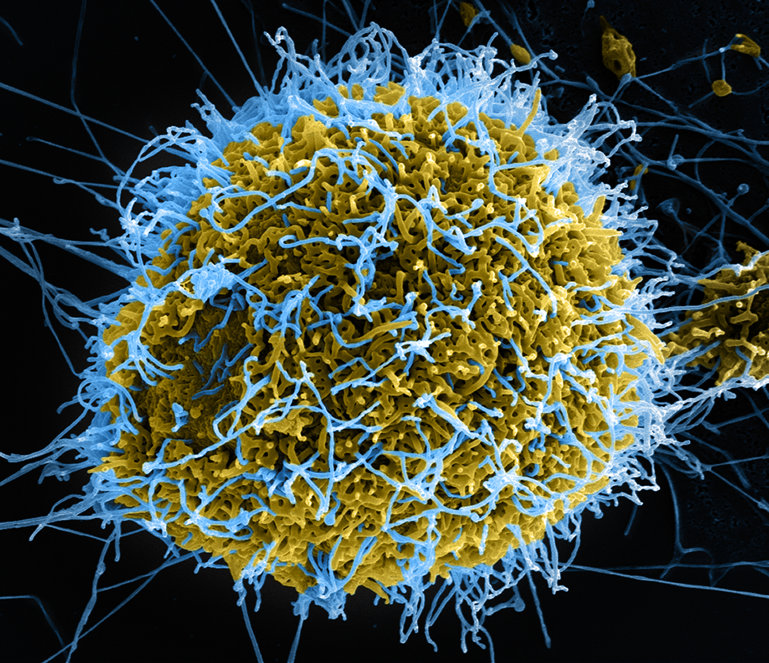 Colorized scanning electron micrograph of filamentous Ebola virus particles (blue) budding from a chronically infected VERO E6 cell (yellow-green). Credit: National Institute of Allergy and Infectious Diseases, National Institutes of Health
