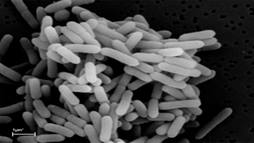 An image of the bacterium Caldicellulosiruptor bescii, named for the DOE BioEnergy Science Center (BESC).