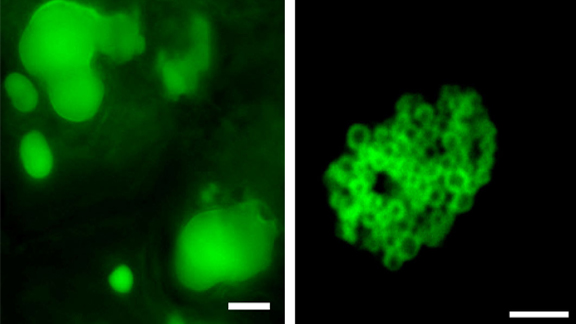  Increasing oil content in leaves: overexpressing the gene for an enzyme involved in oil production caused plant leaves to accumulate large amounts of oil in large globules (left). When the scientists added a second gene, clusters of smaller, more stable oil droplets formed (right).