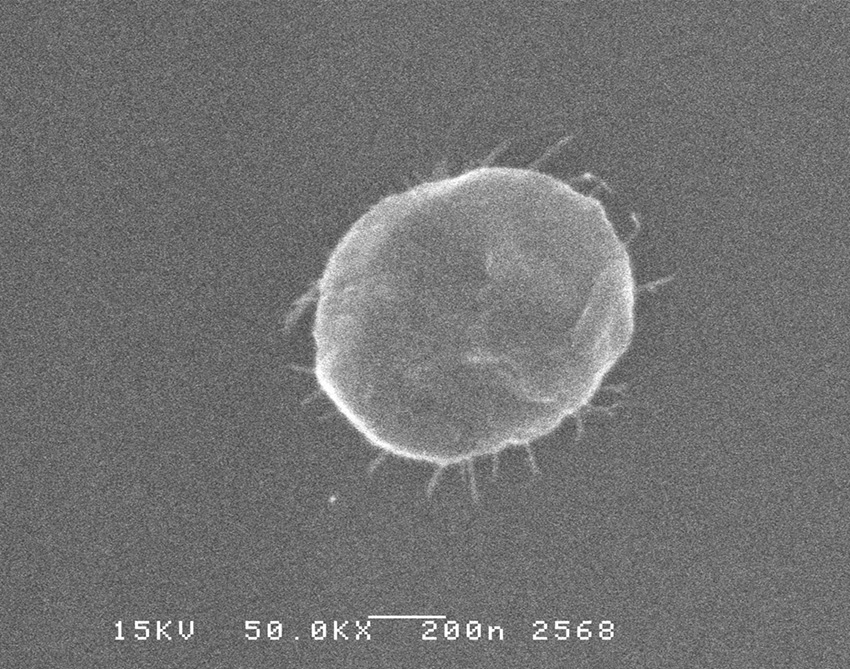 bacterial-b-large.jpg