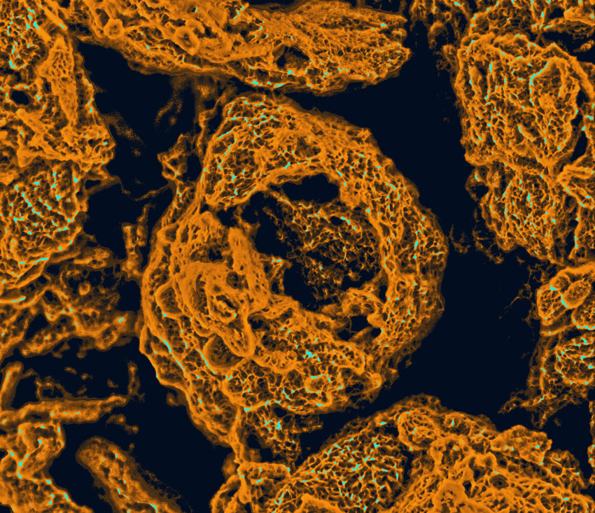 Hierarchically porous electrode made of self-assembled functionalized graphene sheets.