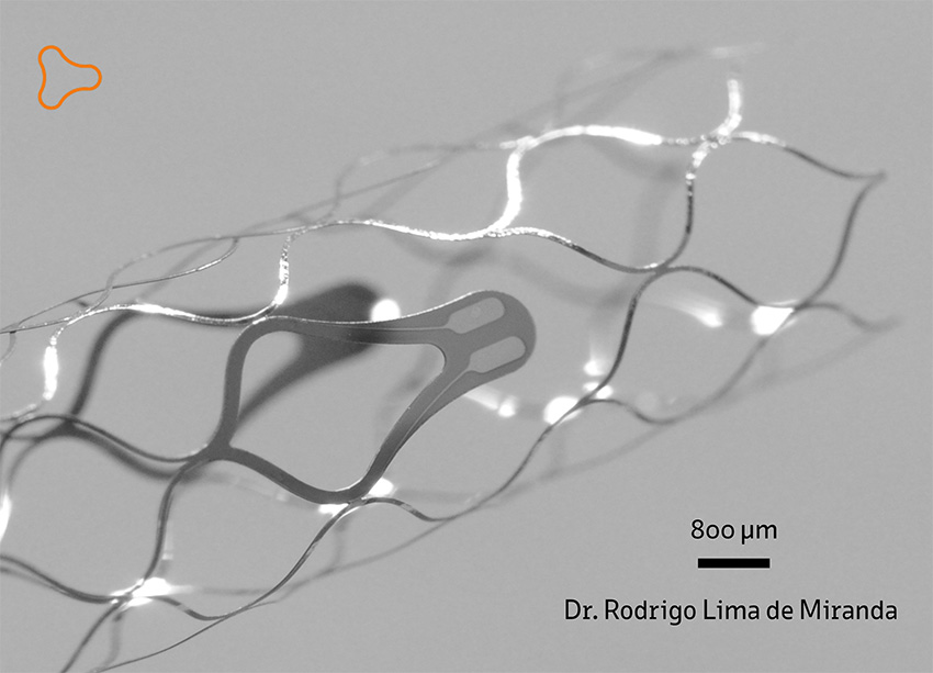 Shape memory alloys are used in coronary stents that expand in arteries to hold vessels open.