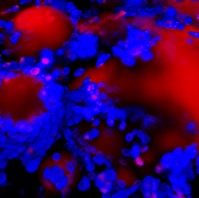 Yarrowia lipolytica surrounding and growing on polyolefin oil droplets (large red circles). Cells were stained blue to show the chitin cell walls and red to show the lipid bodies inside the cells and the oil droplets outside the cells